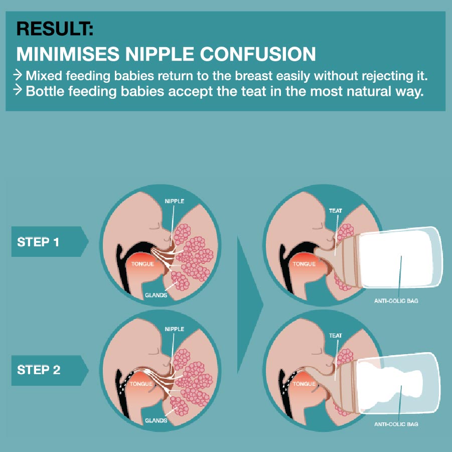 Zero Zero Anti-Colic Bottle 180ml - Adaptable Flow